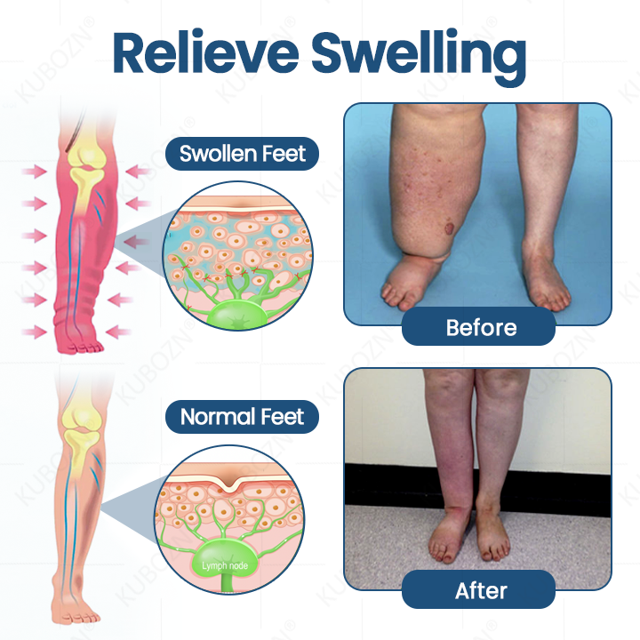 🌟KUBOZN® Roll-On Pump Cream for Lymphatic Drainage & Swelling Relief