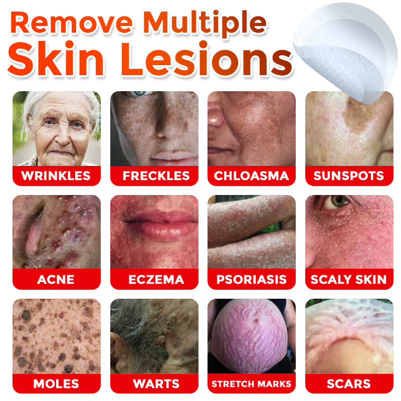 Cvreoz® MicroNeedle Botanic Skin Tag Removal Patch 🇺🇸 Made in the USA